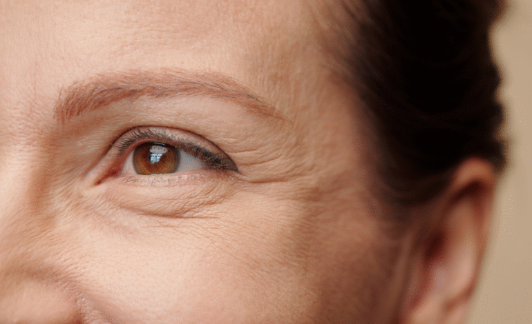 Common Causes of Sunken Eyes and Under Eye Hollows